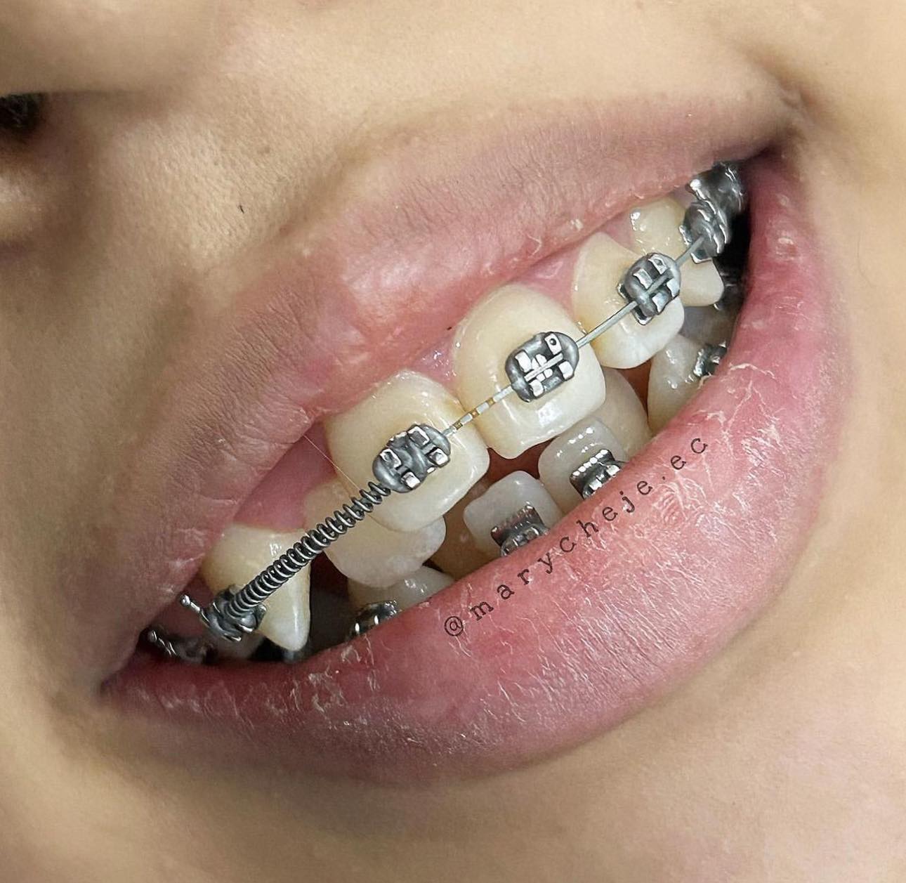 489424917_1200245212104149_1224422469636767380_n