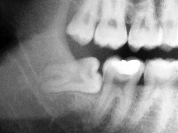 555755535_25180220954909035_1228763511600866565_n