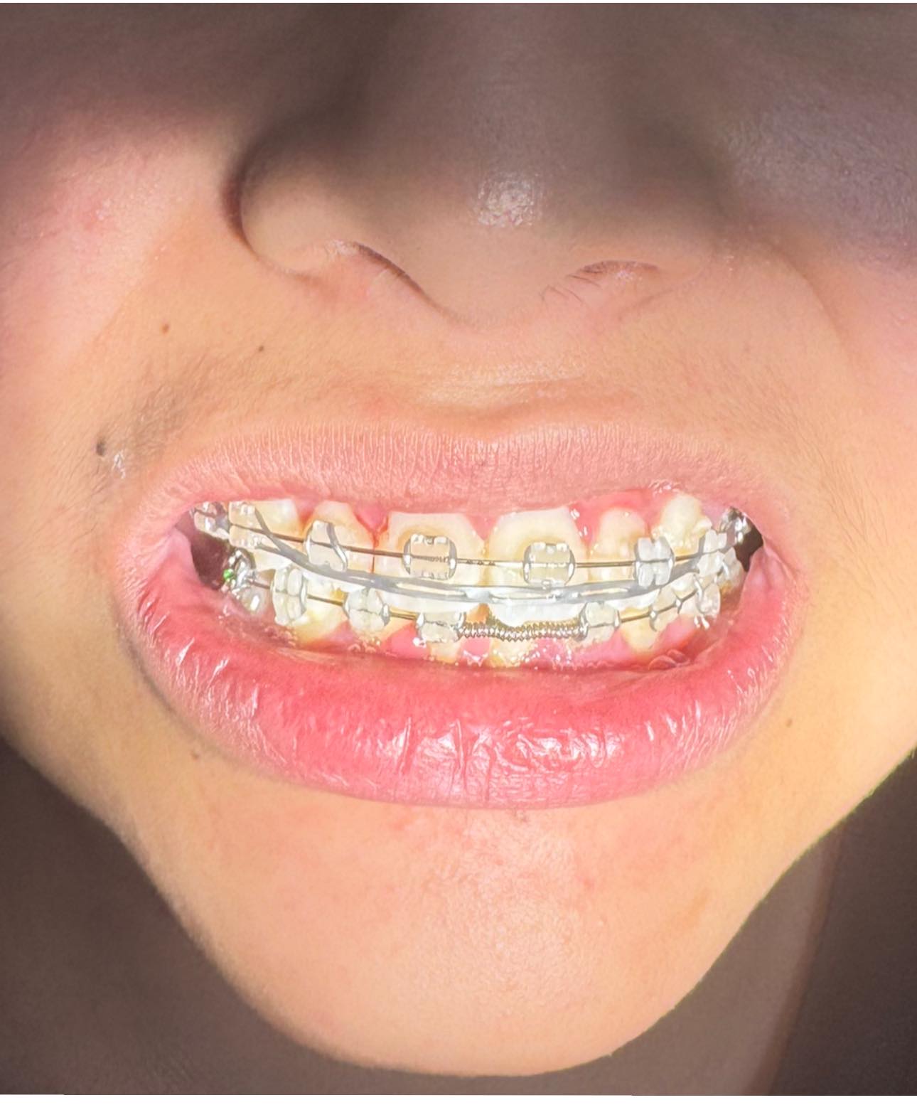 565704022_1368585865270082_443781200154959110_n