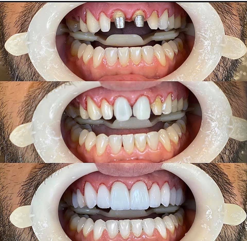 94335132_3202282089796237_2137569184148619264_n